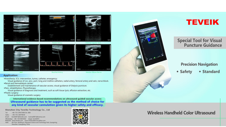 Wireless Ultrasound Tranducer Android Color Doppler Ultrasound Probe Wireless Charging