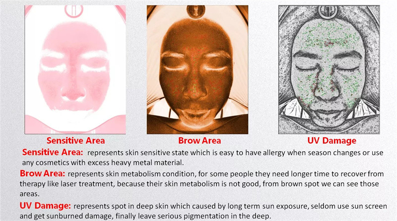 Portable Ai 20 Million Facial Scanner Skin Analyzer 3d Uv Magic Mirror