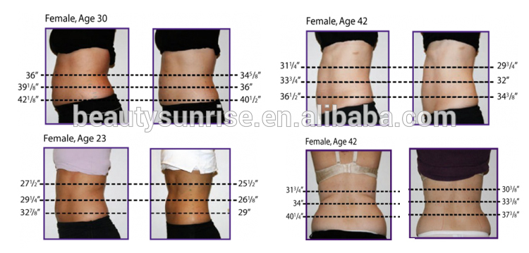 lipo laser 650nm.jpg