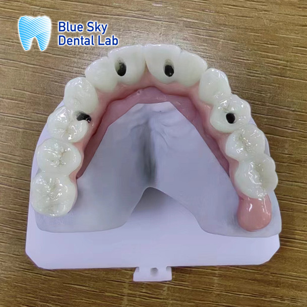 Smooth Surface Implant Cases Steam Sterilization Dental Implant Cases