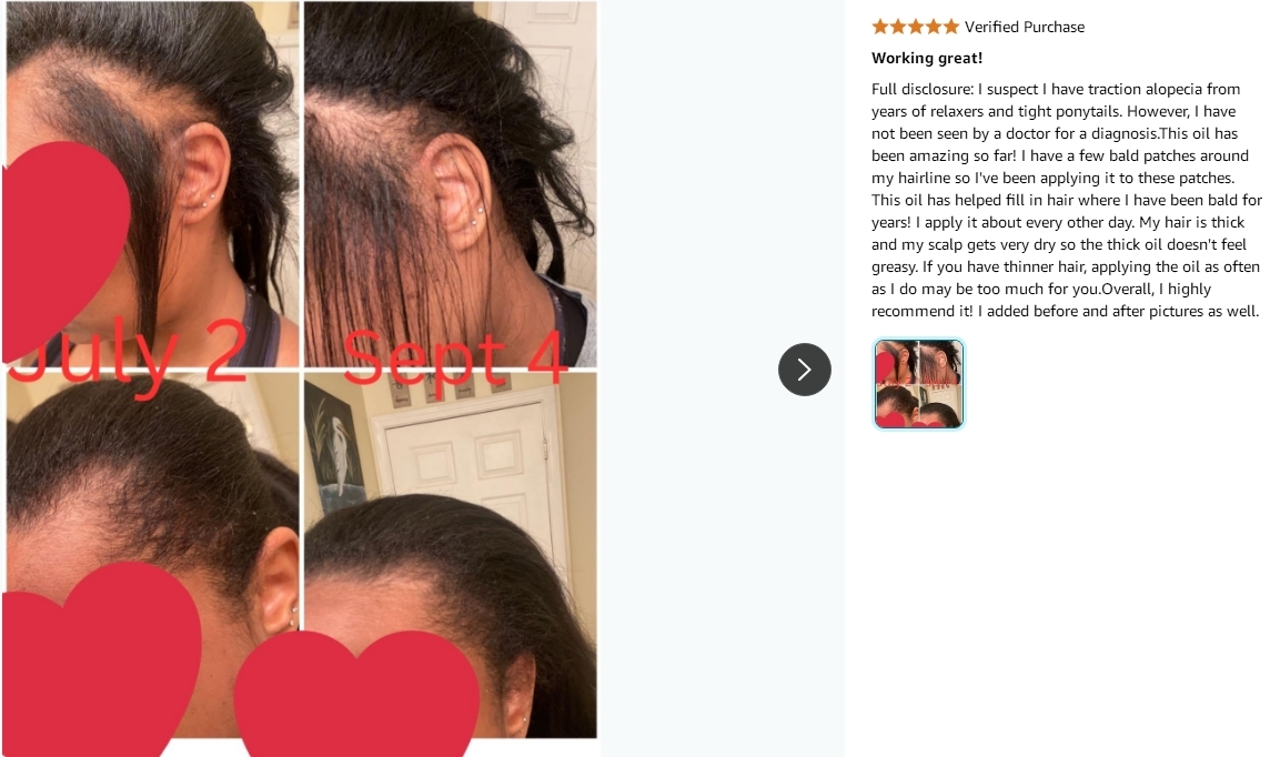 Biotin Enriched Rosemary Mint Hair Regrowth Shampoos Deep Cleansing for Fragile Damaged Hair