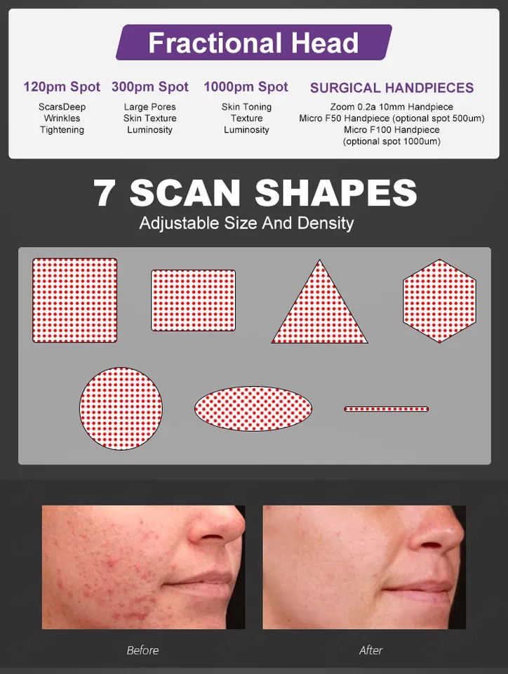60W Ractional Co2 Laser Beauty Machine 220V Fractional Laser Resurfacing Machine Stationary