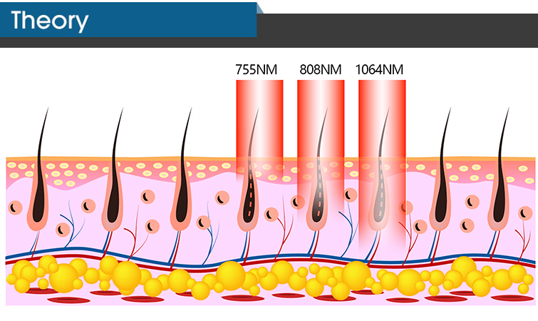 1600-2400W CE ISO 755 808 940 1064nm 4 Wave Diode Laser For Hair Removal Ice Titanium Available