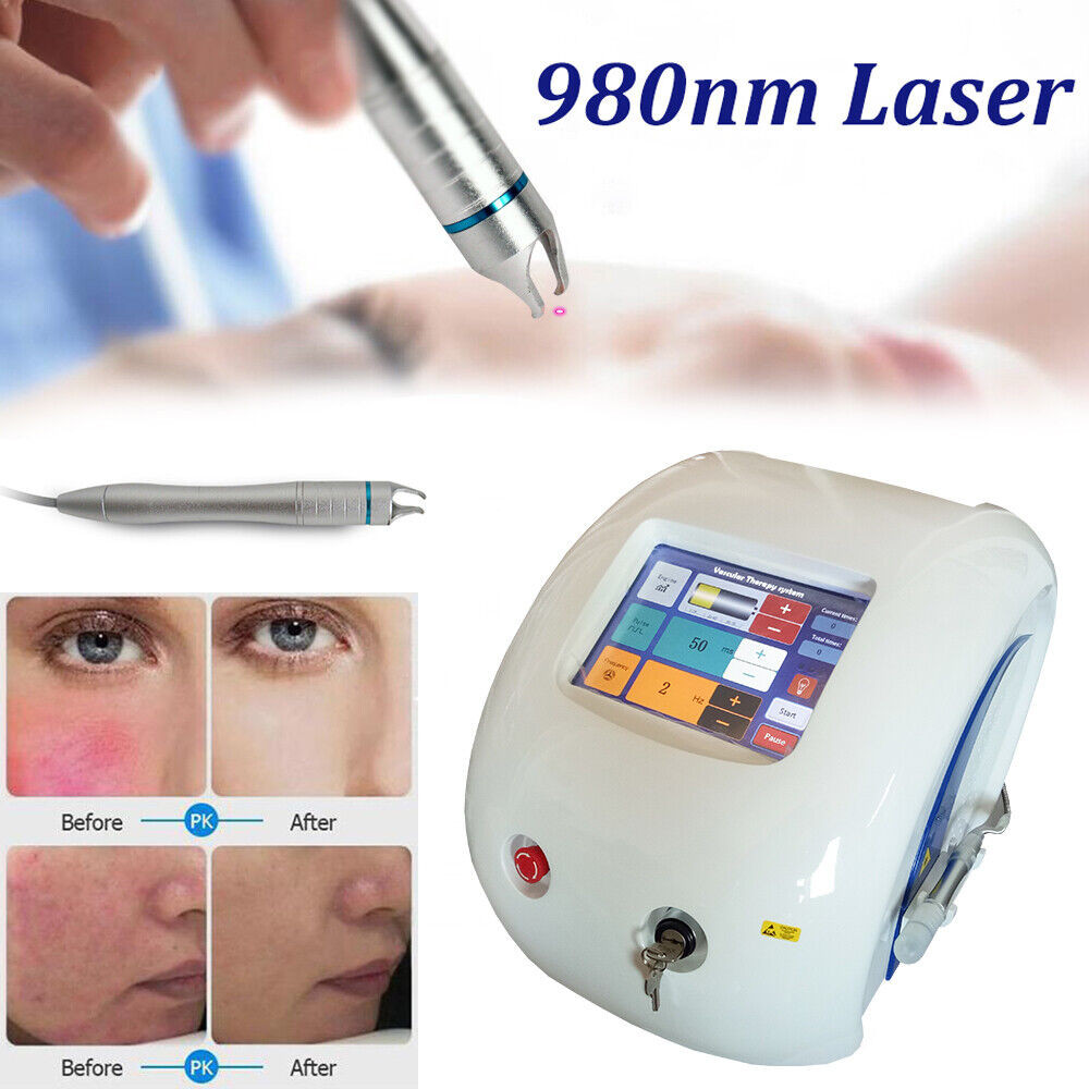 Portable 30w Vascular Laser Spider Vein Removal Machine Facial Leg 980nm Diode