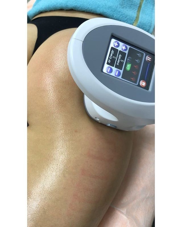 Cavitation Rf Slimming Machine