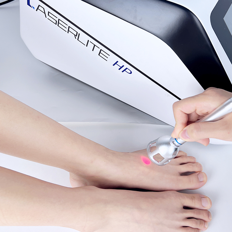 High Power Laser Physical Therapy Instrument. Medical Instruments for Pain Relief Physical Therapeutic Apparatus