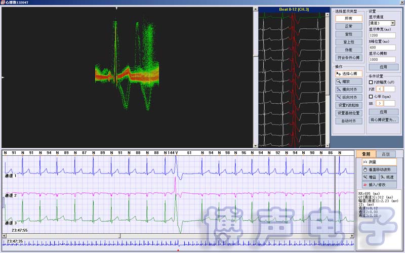 Wearable Ambulatory ECG Patch Monitors single Lead or 3 leads 24-hour Holter, long-term Holter, cardiac event monitoring