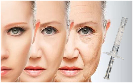 Anti Aging Face Lift PCL Skin Booster 2ml Polycaprolactone Hyaluronic Acid
