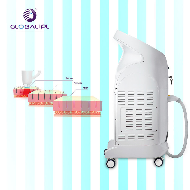 755 808 1064nm Hair Removal Equipment , Diode Laser Treatment For Hair Removal