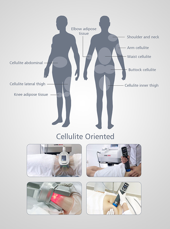 ESWT Fat Freezing Machine Cryolipolysis With Shock Wave 2 In 1 Machine Therapy
