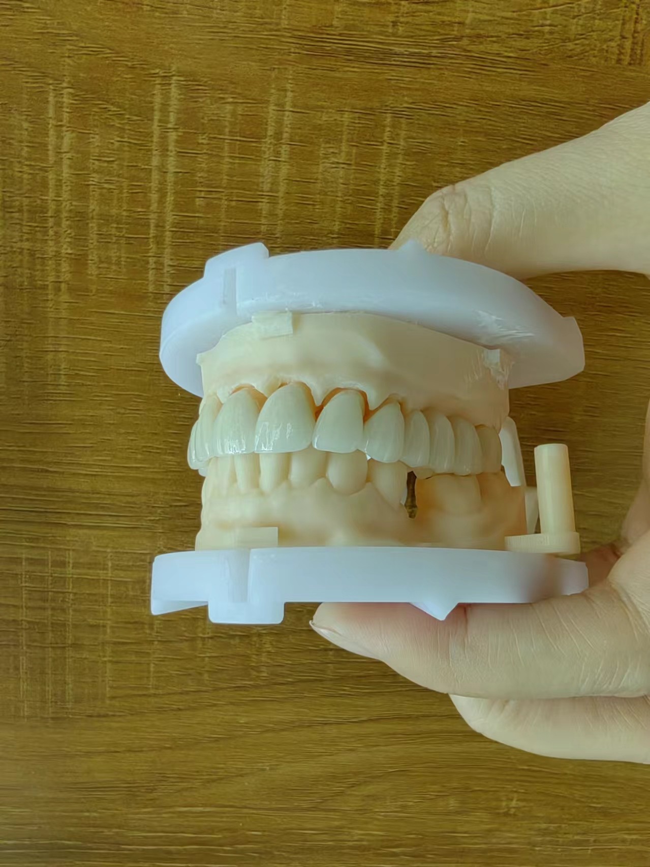 Layered Zirconia Bridge For Fixed Restoration Beautiful Smiles Professional Stable