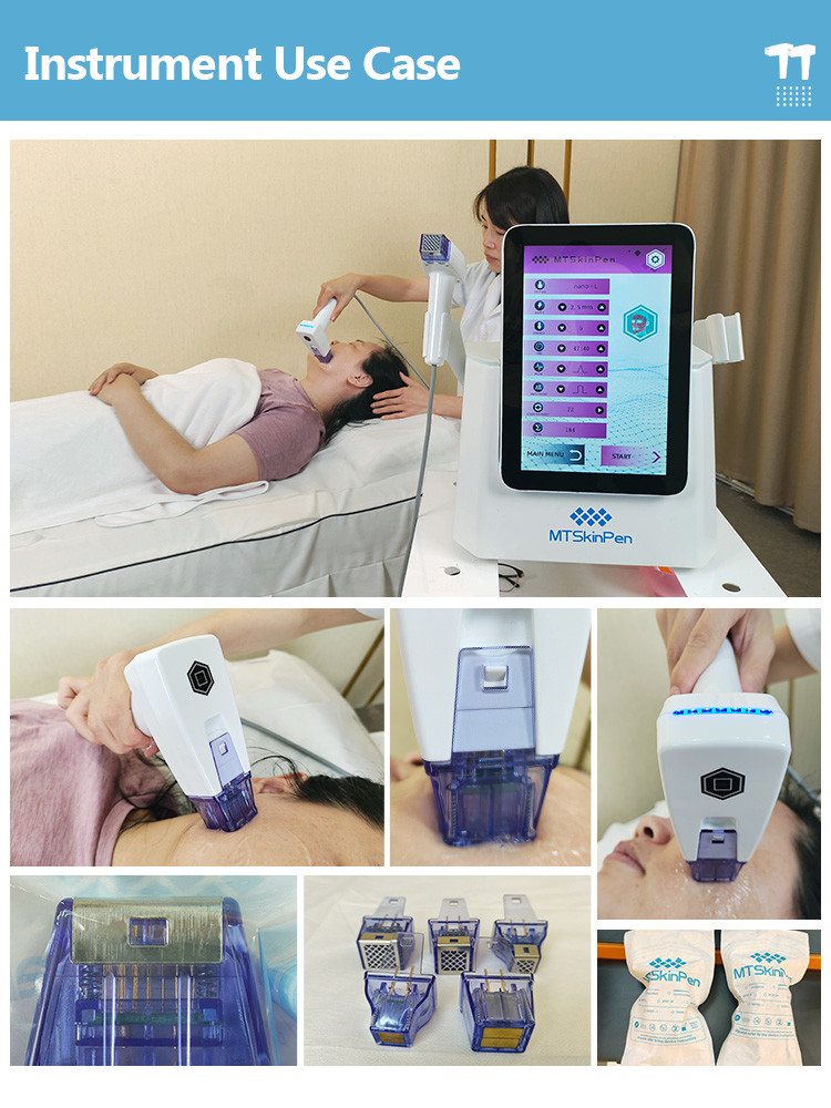 Radio Frequency Equipments RF Microneedling Machine With 10 12 MHz Frequency And High Frequency