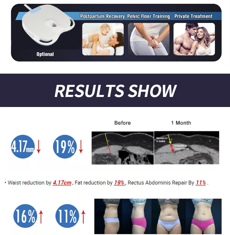 EMS Home muscle-building Magnetic Lean plus Roller magnetic shaping sculpt fat removal slimming body firming skin burning