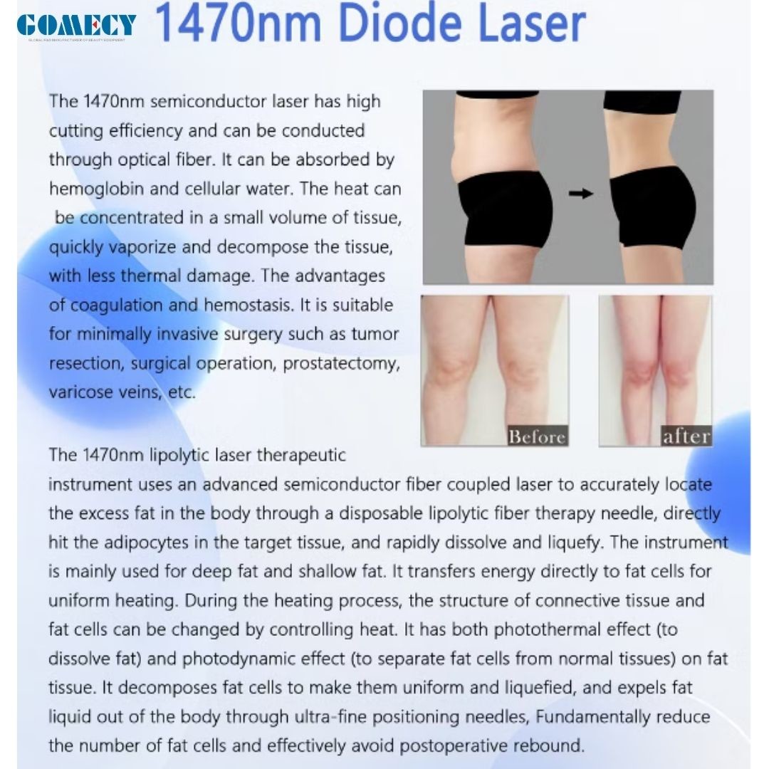 GOMECY 1470nm 980nm/30W Fat Reduction Endolift Laser Device Endolaser Fat Cellulite Reducer Machine