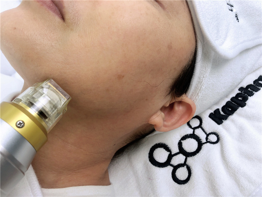 Thermal Cooling Microneedling Fractional RF Face Lifting