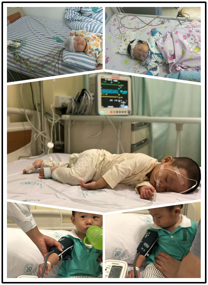 CE Banana To Clip Adapters AHA Ecg Electrodes Pediatric