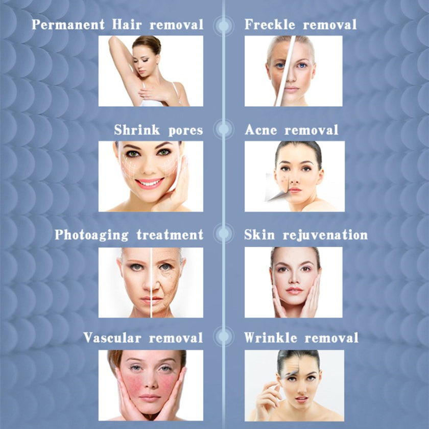 650-950nm IPL Shr Laser Hair Removal 50W White And Bule