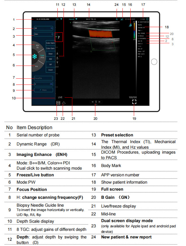 GH G10RL USB Portable Color Doppler Ultrasound Transducer Machine
