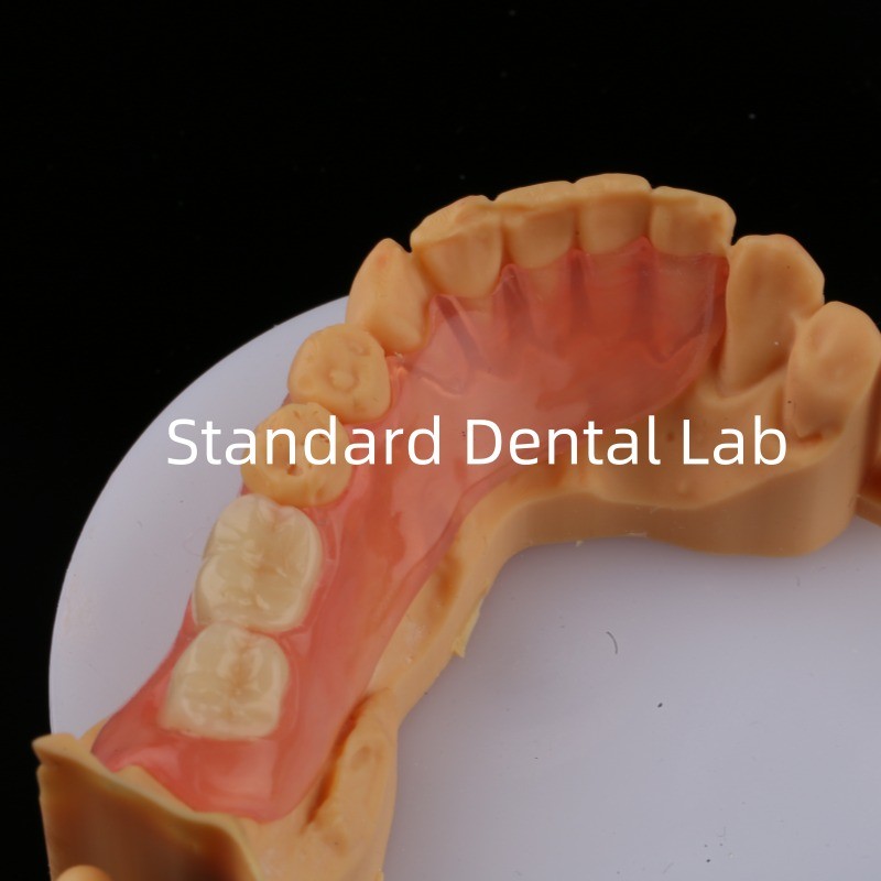 Ace Teeth Pink/Dark TCS Valplast Flexible Partial Dentures for High Esthetics Dental 3D Print Model