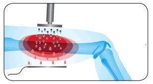 Double 80mm Handle Tecar Therapy Diathermy Machine RF Tecar Microwave Diathermy Equipment For Muscle Relax