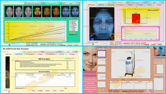 UV / PL Light Skin Analysis Equipment For Skin Care With 3: 4 Preview System