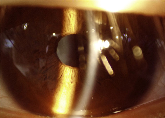 Digital Hand-held Slit Lamp Opthalmology Equipment Used For Anterior Segment Imaging 10X Magnification 16MP Resolution