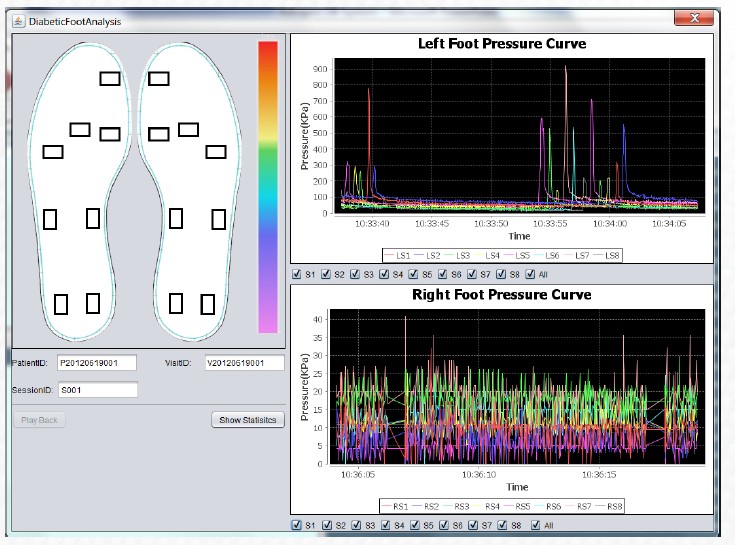 PRESSURE SENSOR FOR FOOT PRESSURE TEST