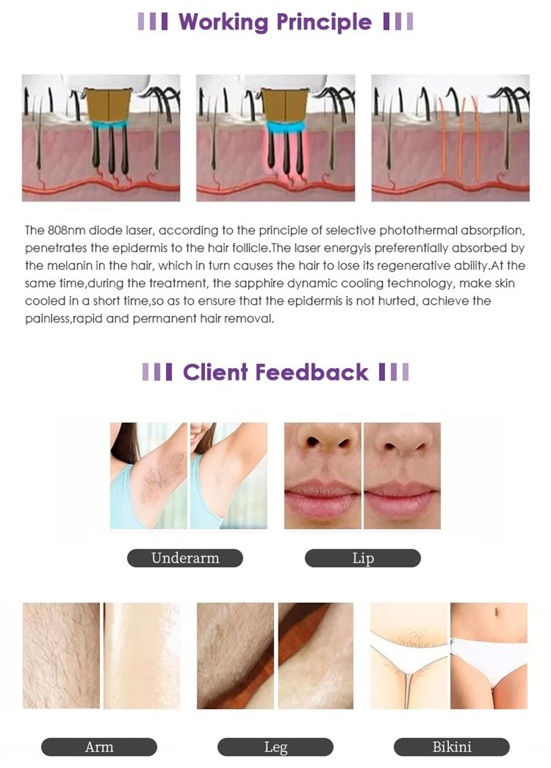 Professional 808nm Diode Laser 2 in 1 Hair Removal Picosecond Laser Tattoo Removal Device