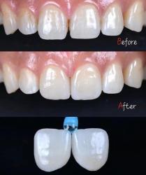 Standard Dental Lab Co., Limited