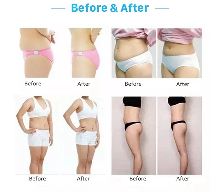 vella shape massage slimming optimal device cavitation machine body contouring