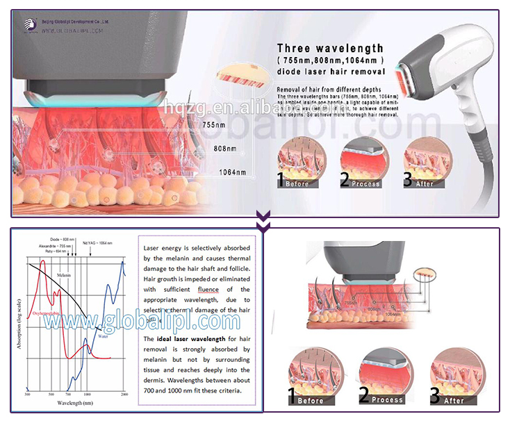 3 wavelength diode laser2.png