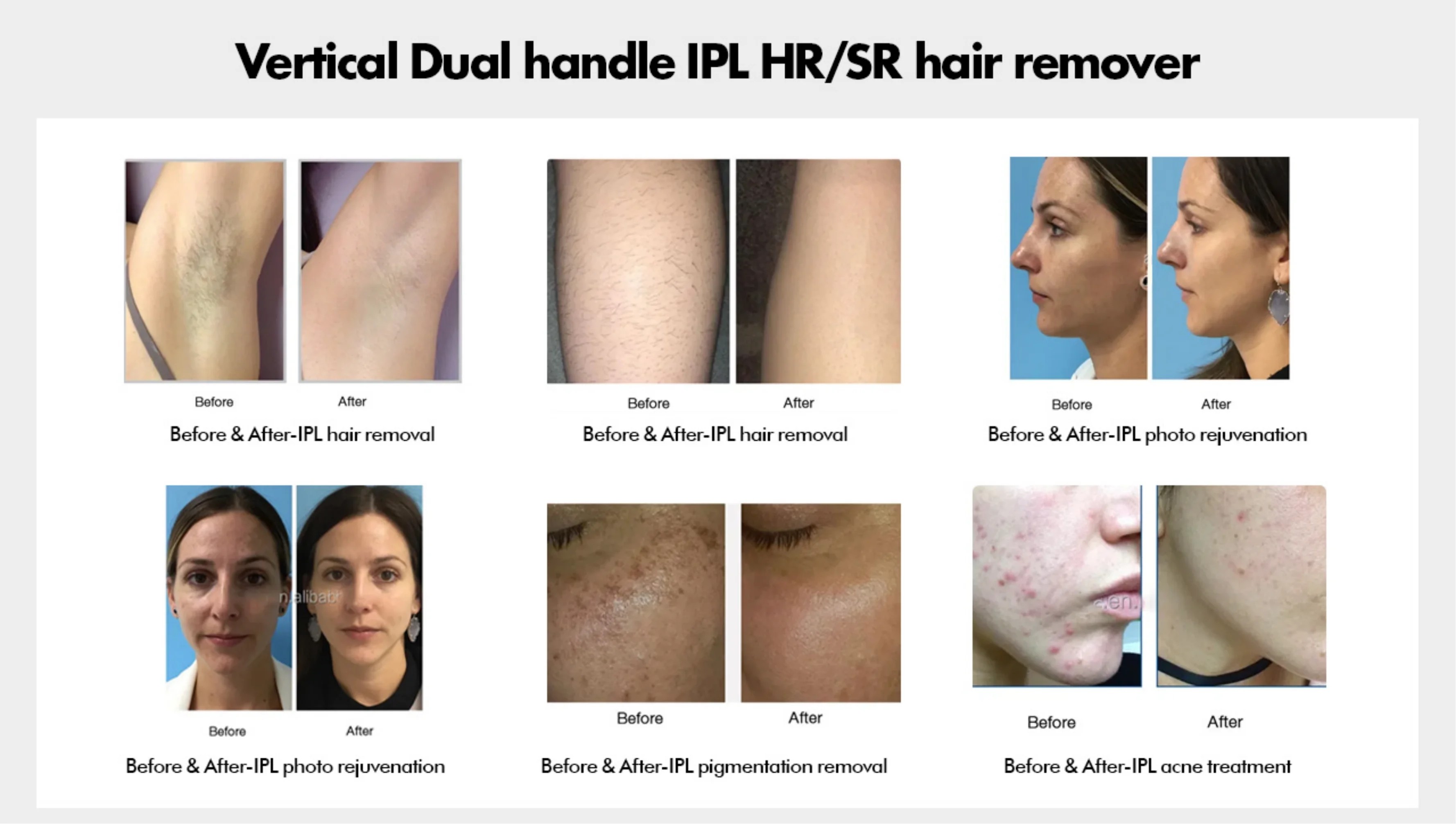 Professional Permanent IPL OPT Epilator Skin Rejuvenation Hair Removal Machine