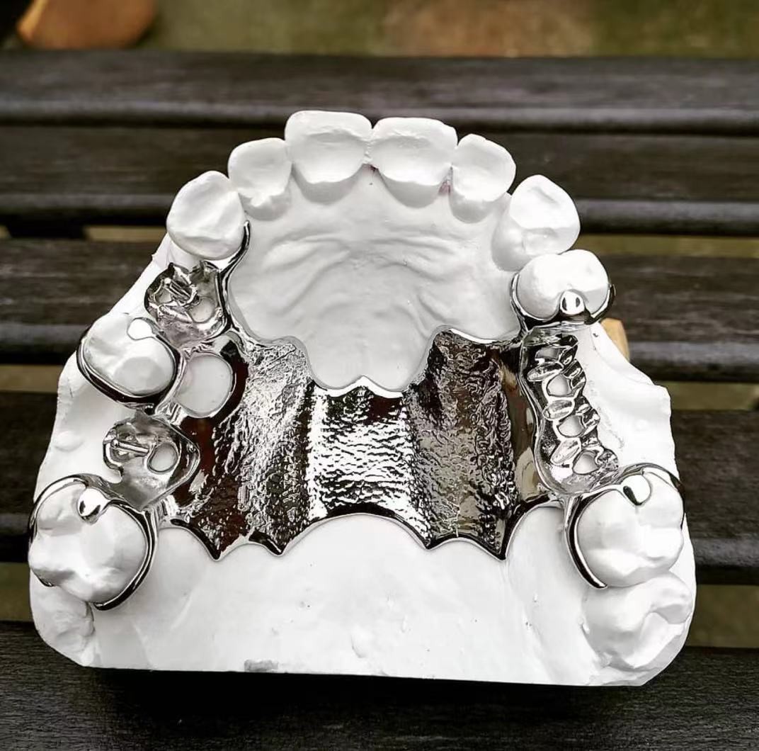 Cobalt Chrome Removable Partial Denture Framework Laser Printing Ni Be Free
