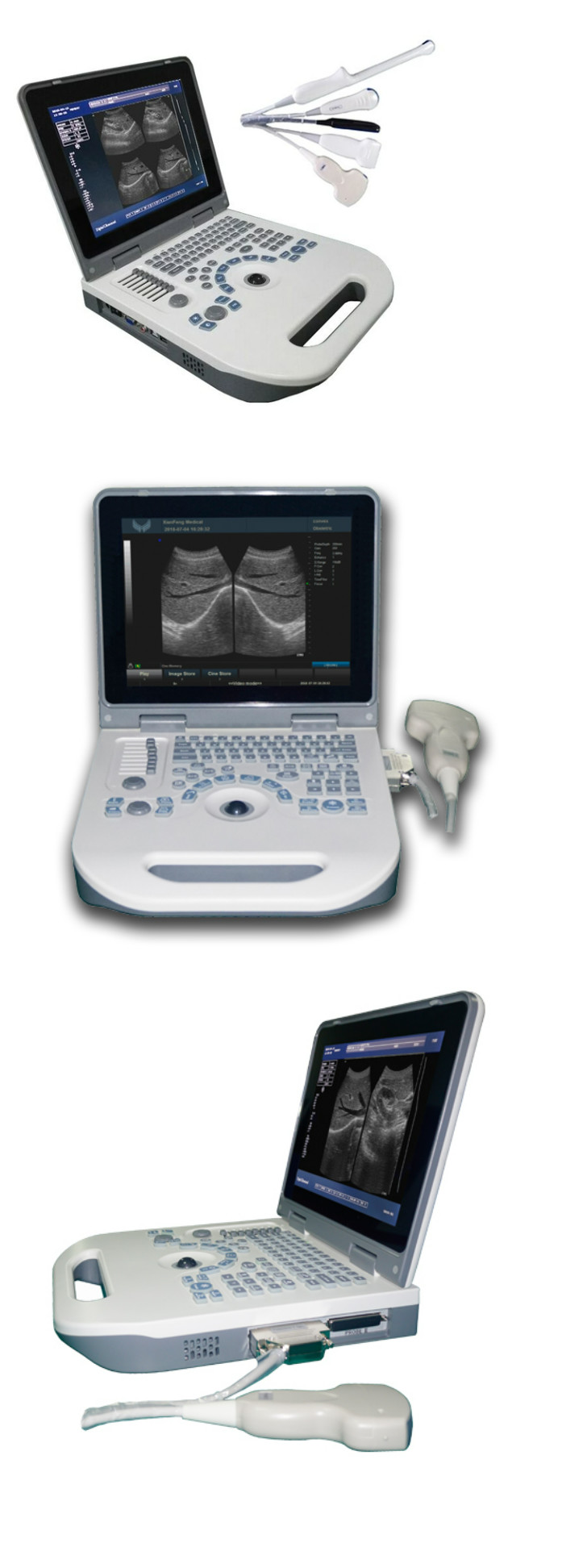 4D Color Ultrasound Portable Ultrasonography Machine Digital