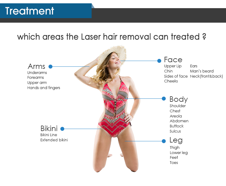 1600-2400W CE ISO 755 808 940 1064nm 4 Wave Diode Laser For Hair Removal Ice Titanium Available