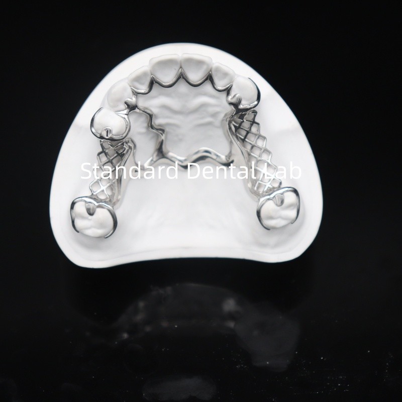 Printed Scheftner Metal Partial Denture Framework Accurate Customized Cast Partial Denture