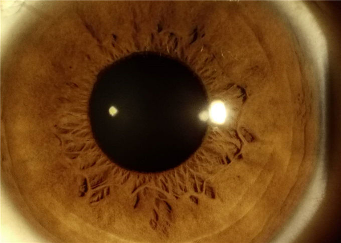 Digital Hand-held Slit Lamp Opthalmology Equipment Used For Anterior Segment Imaging 10X Magnification 16MP Resolution