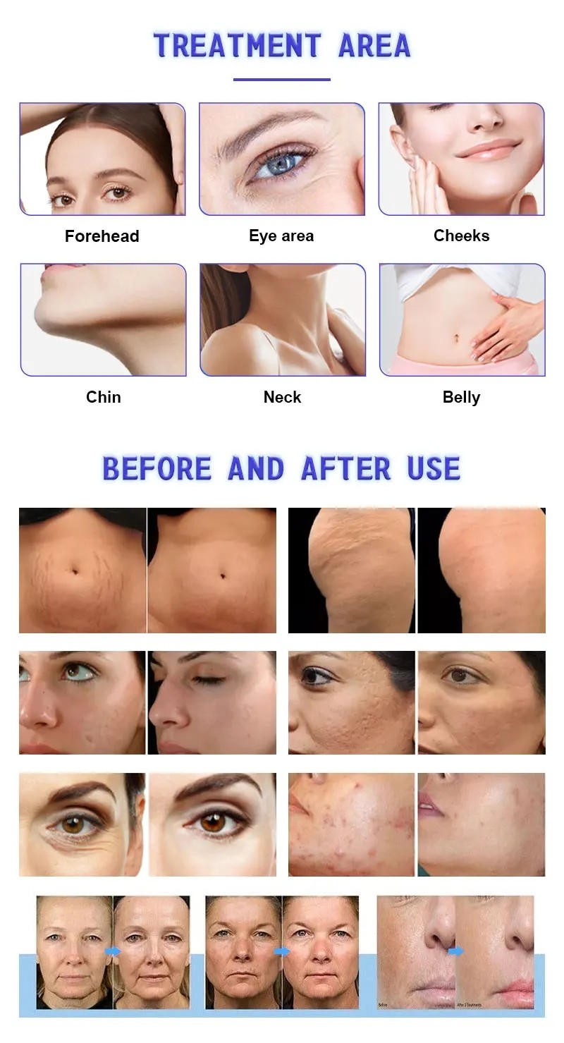 2024 3 In 1 Inmode Morpheus 8 Body Slimming Beauty Machine Radio Frequency Equipment RF Skin Tightening Machine