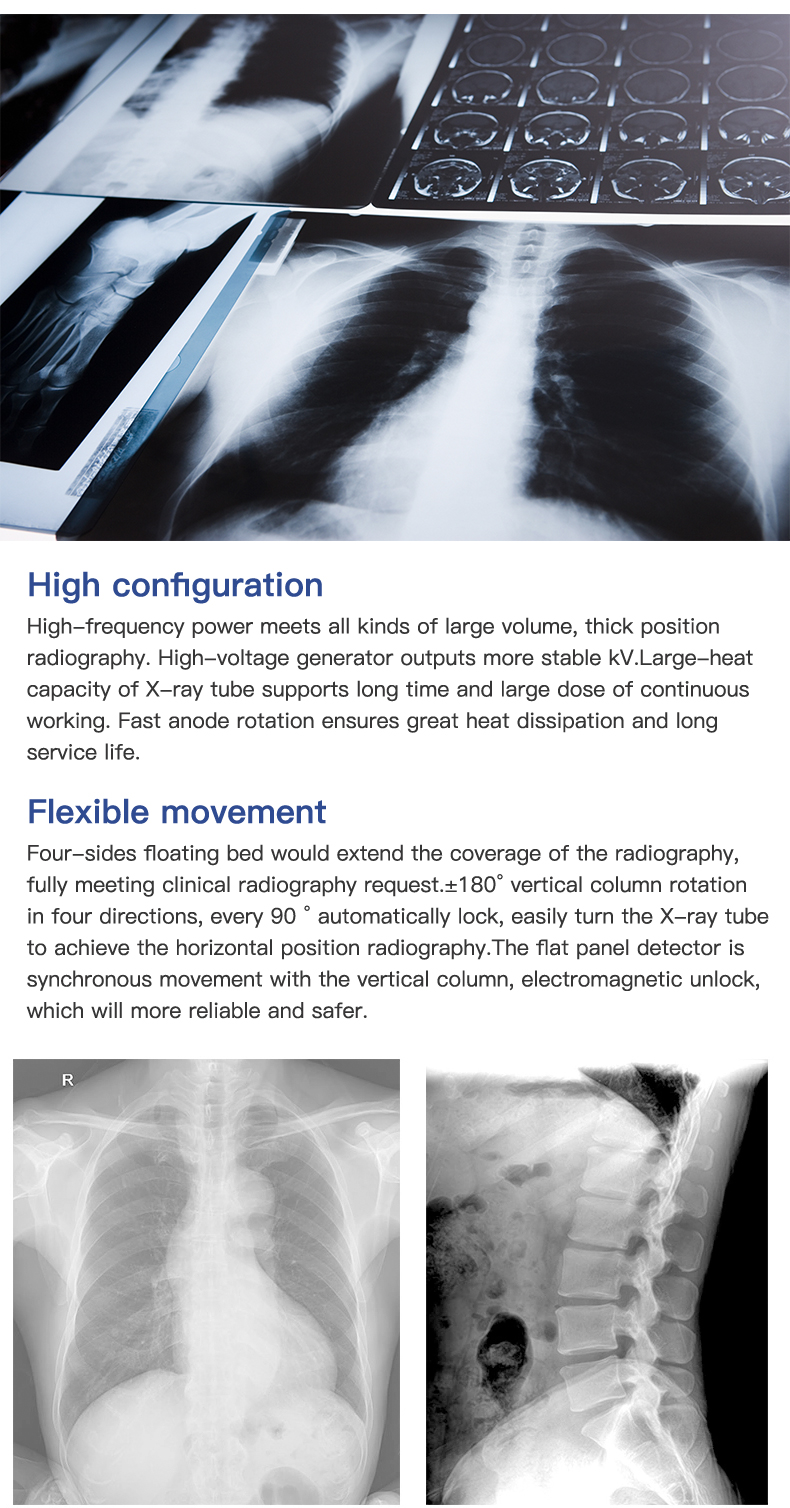 High Frequency Mobile Digital Radiography Machine Digital X Ray Equipment