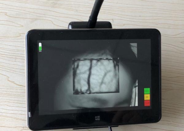 Resolution of 800*1280 Near Infrared Projectiion Vein Finder Portable Medical