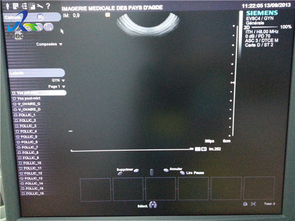 Siemens EV-8C4 Ultrasound Transducer Probe Endocavitary