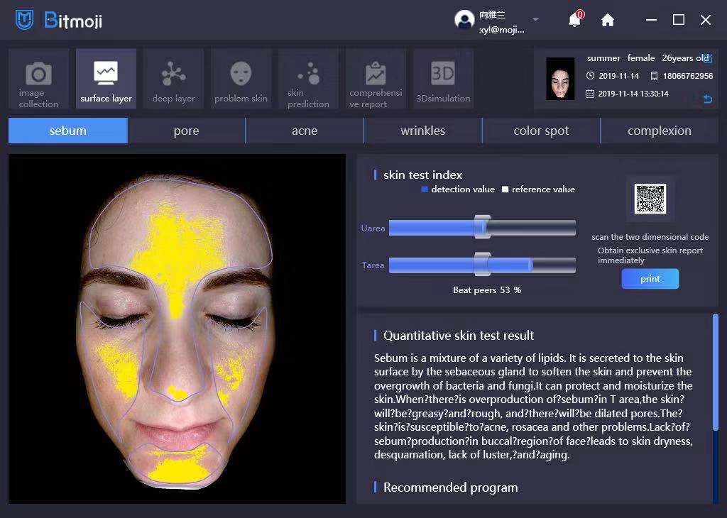 80w Power Intelligent Lasertell Skin Analysis System