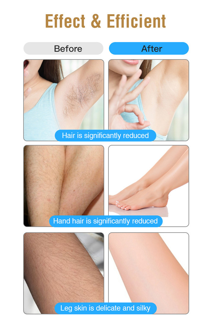 360 ICE Cool FCC 3cm2 IPL Hair Removal Device 990000 Flashes