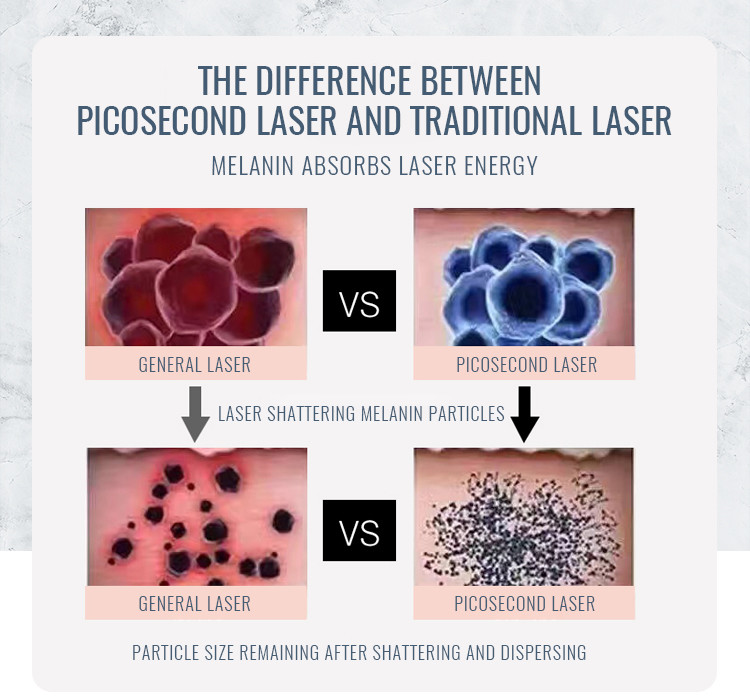 2500w Salon Picosecond Laser Tattoo Removal Machine For Pigmentation Remove