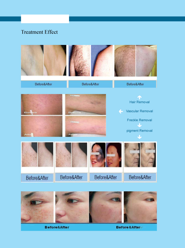 8.4inch Touch Screen IPL Hair Removal Machine For Beauty Salon / Cosmetic Salon