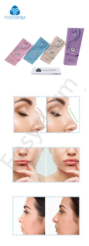 Anti Wrinkle Injectable Dermal Filler For Face Contouring