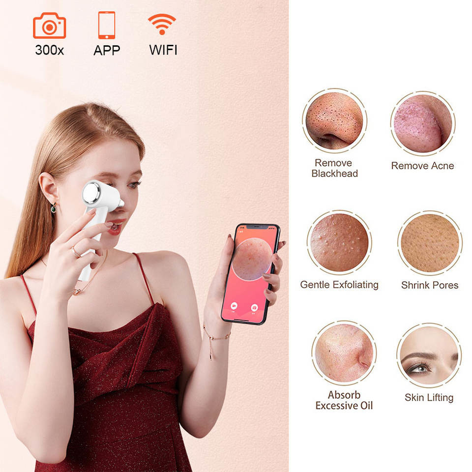 ABS Plastic Deep Cleansing Facial Machine Electric Visual Blackhead Remover Vacuum Suction