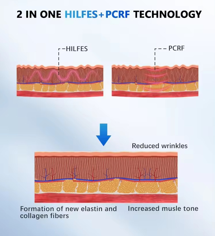 Portable MFFACE Pe-Face RF Microcurrent Face Lifting Double Chin Removal Machine