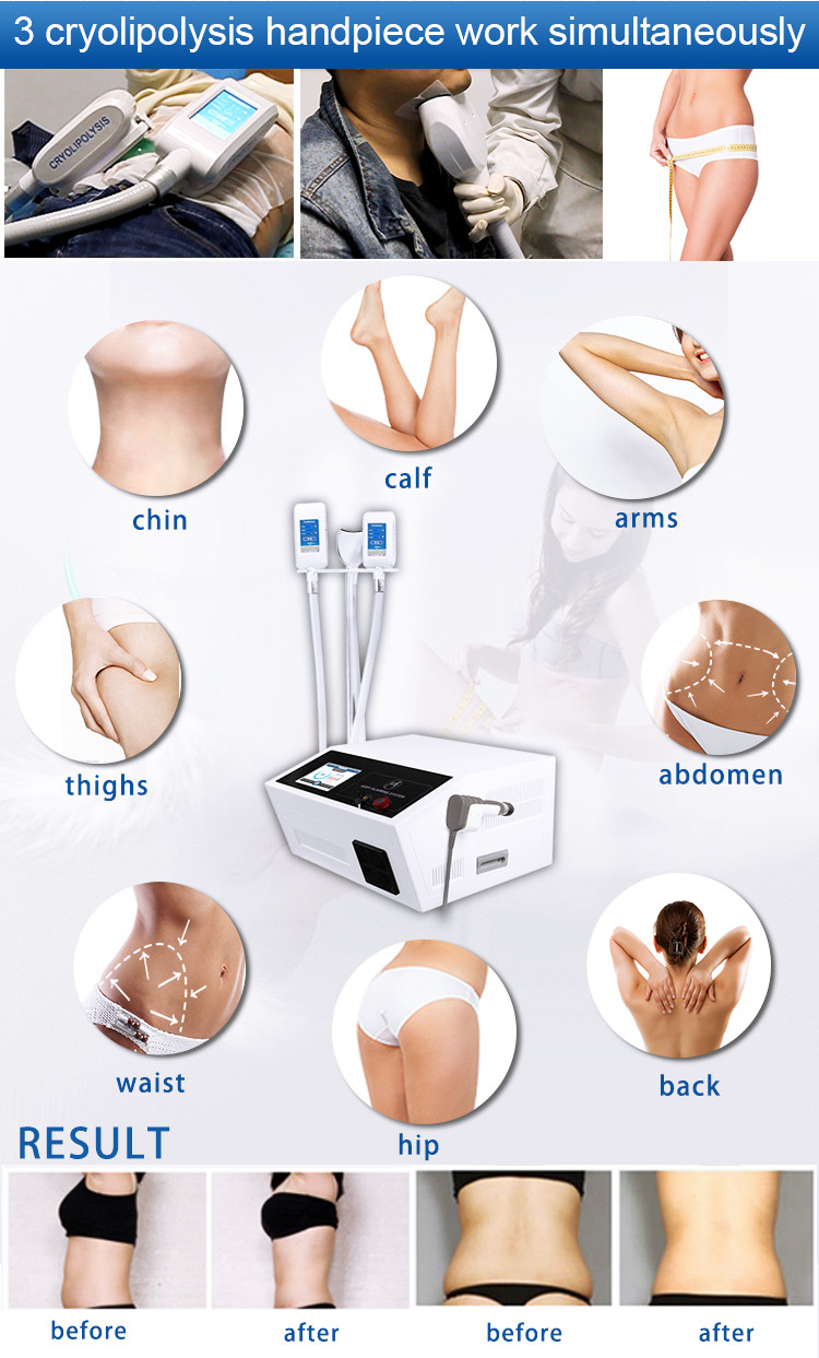 2 In 1 Multifunction Cryolipolysis Fat Freezing Machine With 4 Handle
