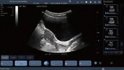 Mobile Phone Probe Wireless Ultrasound Probe Convex Linear Transvaginal Micro-convex Changeable Probe